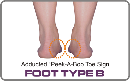Foot Type B has a valgus forefoot