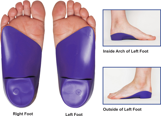 Little steps store foot orthotics