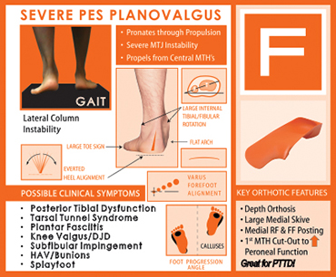 Symptoms and Features of the F Quad