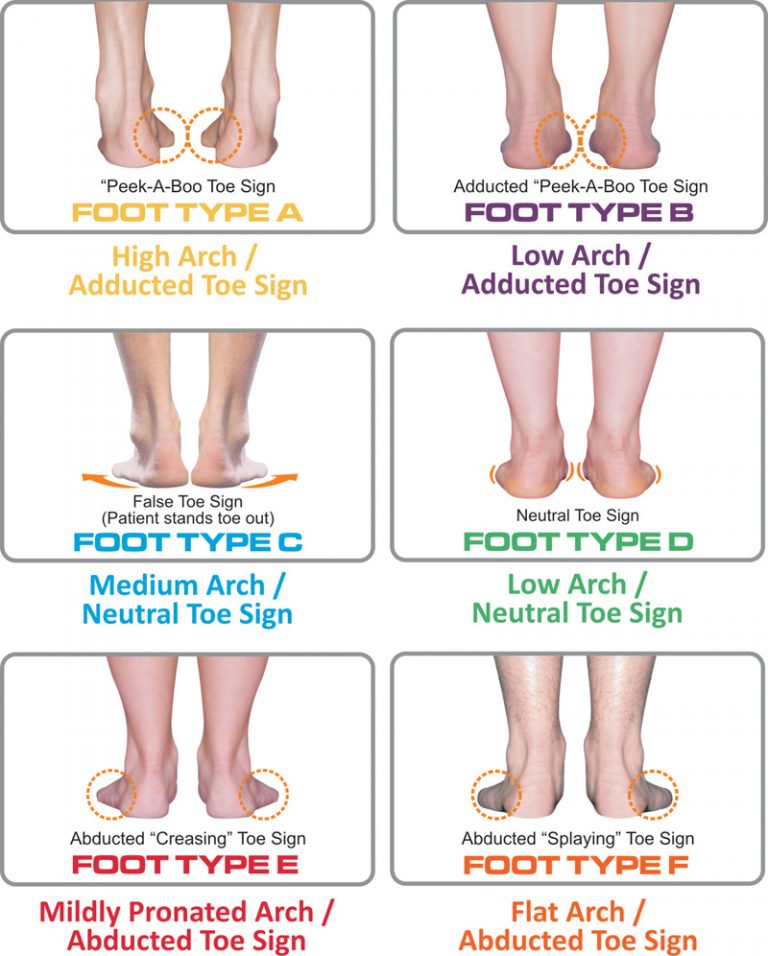 Toe In Example Did You Know – There are Just 4 Simple Steps to Foot Typing? – Nolaro24 ...