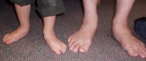 Your Foot Type is Inherited